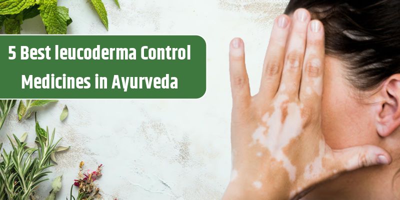 leucoderma-control-medicines-in-ayurveda